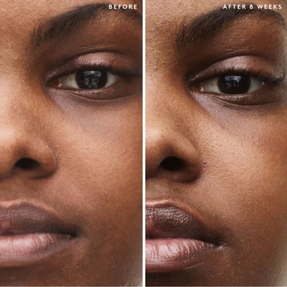 Fenty Skin Travel-Size Start’r Set  Dry Skin Edition NEW - Picture 6 of 10